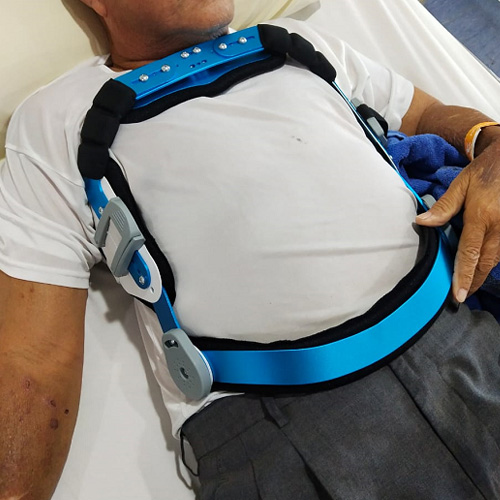 BHW Medical Equipment – Orthopedic Product Close-up